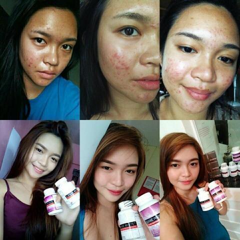 Luxxe White Enhanced Glutathione Best Effective Skin Whitening Supplement